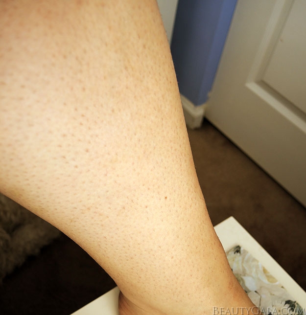 Tria Beauty Hair Removal Laser 4X Review: 5 Weeks Into My Journey